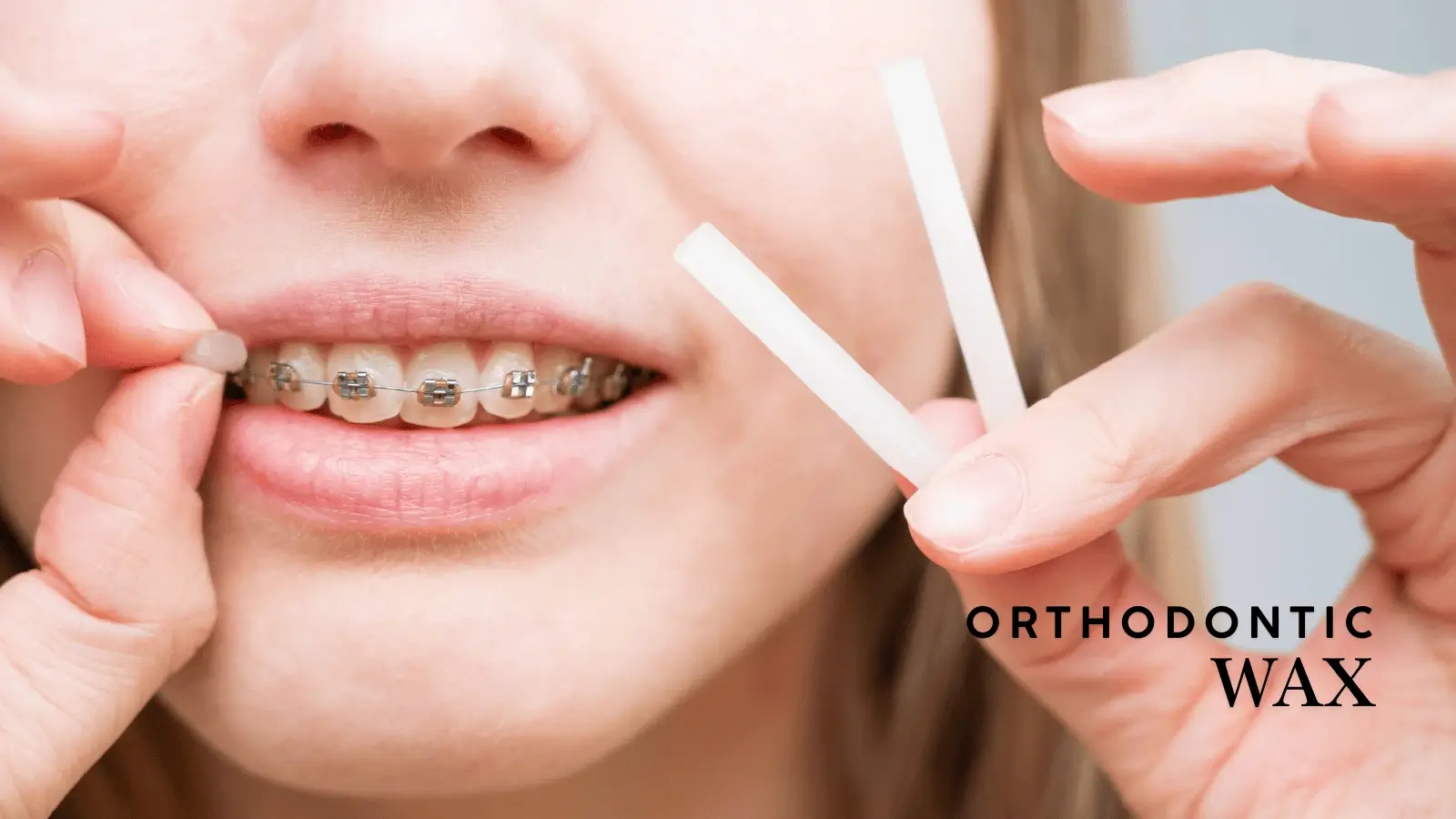 Orthodontic Wax for Invisalign Pain Relief